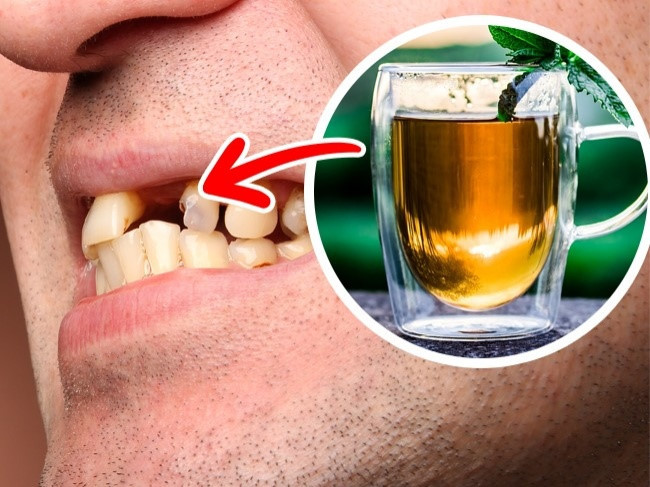 Trà: Mọi người đều biết trà có chứa caffeine, tác động tiêu cực đến cơ thể nếu tiêu thụ nhiều. Ngoài ra, trà cũng chứa flo, dù lượng ít hơn caffeine, nhưng gây hại tới răng. Flo rất cần thiết cho cơ thể, nhưng khi hấp thụ quá nhiều, nó ảnh hưởng đến sức khỏe của xương và răng. Để an toàn, không nên uống nhiều hơn 4 ly/ ngày và không uống các loại trà túi rẻ tiền.
