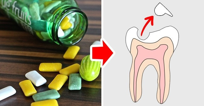Kẹo cao su: Nhiều người nghĩ rằng kẹo cao su không đường có vẻ an toàn cho răng. Tuy nhiên, mối nguy hiểm của nó không phải là đường mà là những tác động tiêu cực của nó lên răng sâu đã được trám, hàn. Bên cạnh đó, nhai kẹo cao su tăng tiết nước bọt, tạo ra kiềm làm mòn men răng, gây sâu răng.