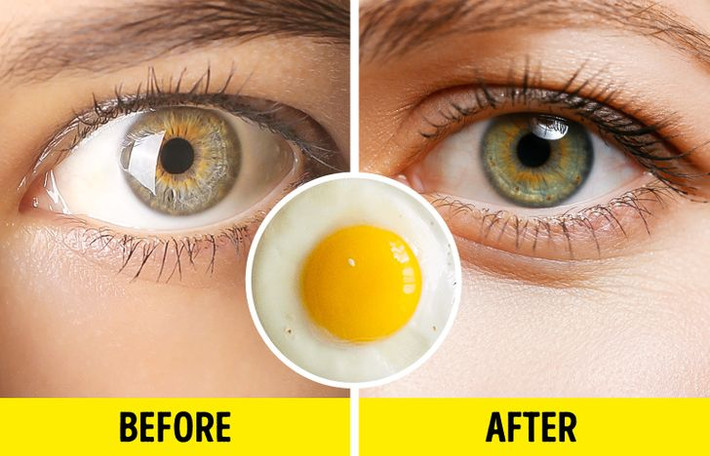 Trứng rất giàu protein. Tóc và lông mi được cấu tạo từ keratin. Thực phẩm giàu protein sẽ cung cấp đủ lượng axit amin cần thiết để sản xuất keratin, nhờ đó, kích thích lông mi mọc dài hơn.
