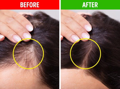 9. Dùng phấn màu tối để dặm chân tóc: Một mẹo trang điểm tóc được nhiều chuyên gia áp dụng đó là dùng phấn màu tối như: nâu, nâu đen, để dặm lên phần chân tóc thưa, giúp ăn gian độ dày tóc một cách hiệu quả. Ảnh: BS.