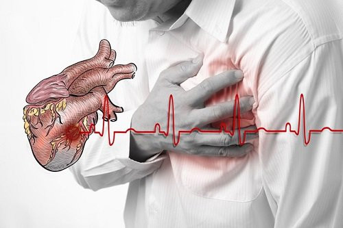 Thiếu máu cơ tim: Lượng máu chuyển đến não sẽ nhiều hơn bình thường khi bạn nổi nóng, khiến máu chuyển đến tim bị giảm xuống. Tình trạng thiếu máu cục bộ ở cơ tim sẽ ảnh hưởng tiêu cực đến sức khỏe của tim.