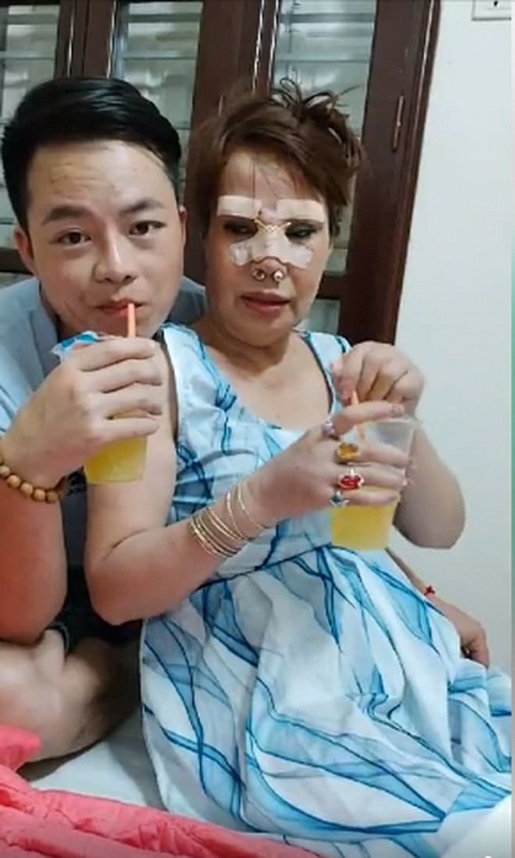 Chị và chồng trẻ đã khăn gói xuống Hà Nội 3 tuần để chuẩn bị cho cuộc phẫu thuật thẩm mỹ.