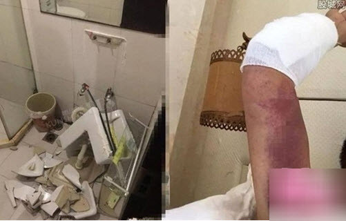 Cuối tháng 6 vừa qua, truyền thông Trung Quốc đưa tin một cặp đôi diễn cảnh “người lớn” quá phấn khích trong khách sạn ở Côn Sơn, Tô Châu, Trung Quốc khiến chàng trai đổ máu. Đang quá phấn khích, không tự chủ được hành động của mình nên cặp đôi đã vội vàng chuyển địa điểm làm tình từ trên giường vào phòng tắm. Thật không may khi bồn tắm cũng không đủ sức nặng để làm nền cho họ thể hiện cảm xúc quá đà của mình.
