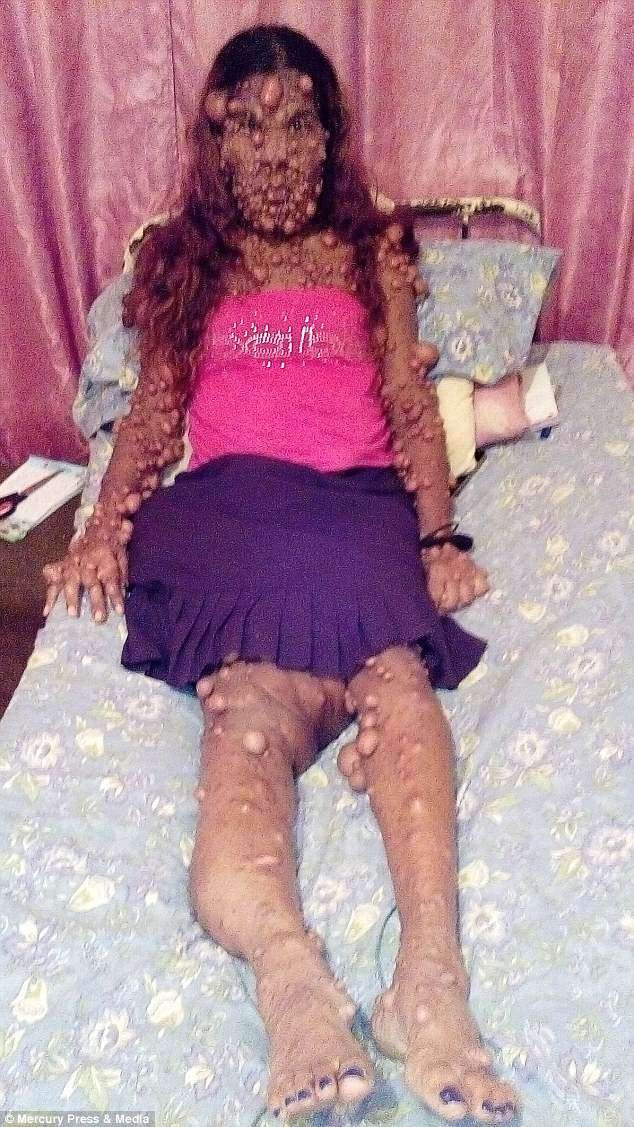 Charmaine đã cố gắng duy trì cuộc hôn nhân của mình đến 18 năm. Tuy nhiên, cuối cùng cũng thất bại, căn bệnh là một trong những lý do chính khiến hôn nhân của cô đổ vỡ.