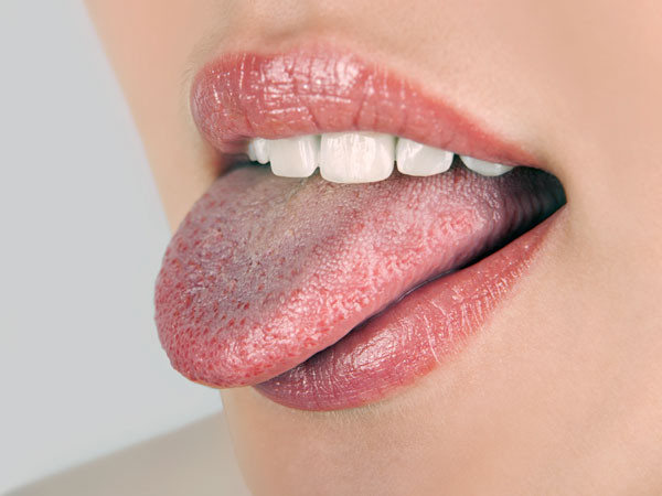 Trên lưỡi xuất hiện những vết sưng phồng màu trắng, đỏ, thêm cảm giác ngứa ngáy khó chịu sẽ là những triệu chứng cảnh báo bệnh ung thư hoặc nguy cơ ung thư vì tế bào này đang hoành hành vùng lưỡi.