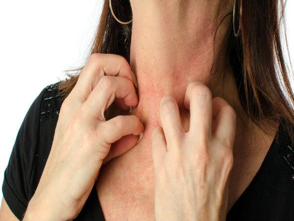 Suy thận khiến chất độc tích tụ trong cơ thể bạn tăng lên, những độc tố này có thể ảnh hưởng và khiến bạn bị ngứa ngáy, phát ban.