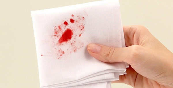 Sau phẫu thuật thì nguy cơ nhiễm trùng, nhiễm khuẩn biến chứng cũng rất lớn vì vùng hậu môn là cơ quan bài tiết nên rất khó giữ vệ sinh và làm vệ sinh thường xuyên. Ảnh: Sống khỏe.