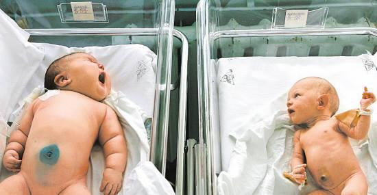 Em bé sơ sinh nặng nhất thế giới là một trong những ca sinh con gây sốc nhất thế giới.