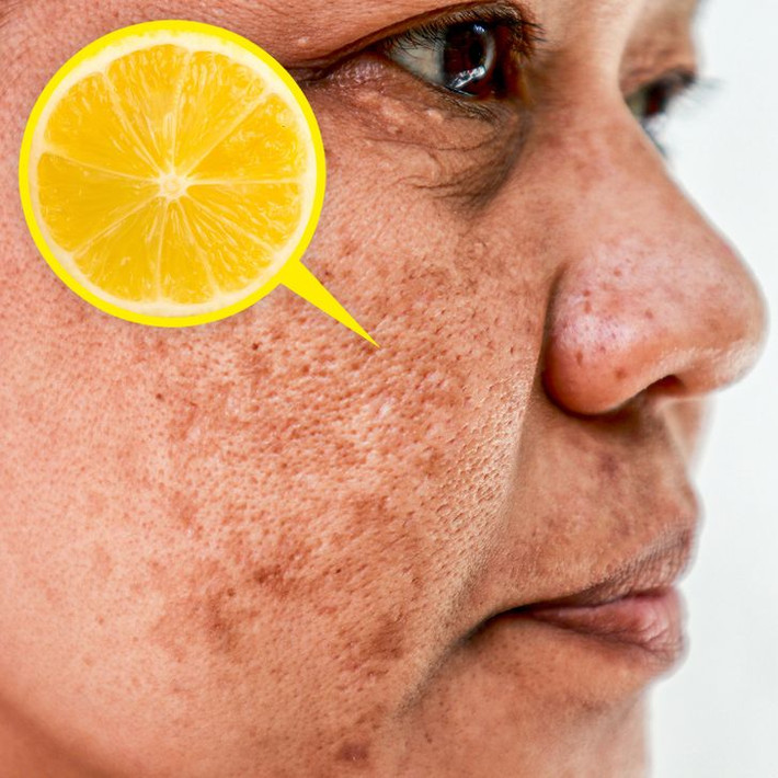 6. Nước chanh làm mặt nạ chống lão hóa: Nước chanh chứa đầy vitamin C và các đặc tính chống oxy hóa khiến nhiều người muốn thêm nó vào mặt nạ chống lão hóa. Tuy nhiên, chanh có thể dẫn đến tăng sắc tố và da bị nám, đó là lý do tại sao bạn sử dụng thận trọng.