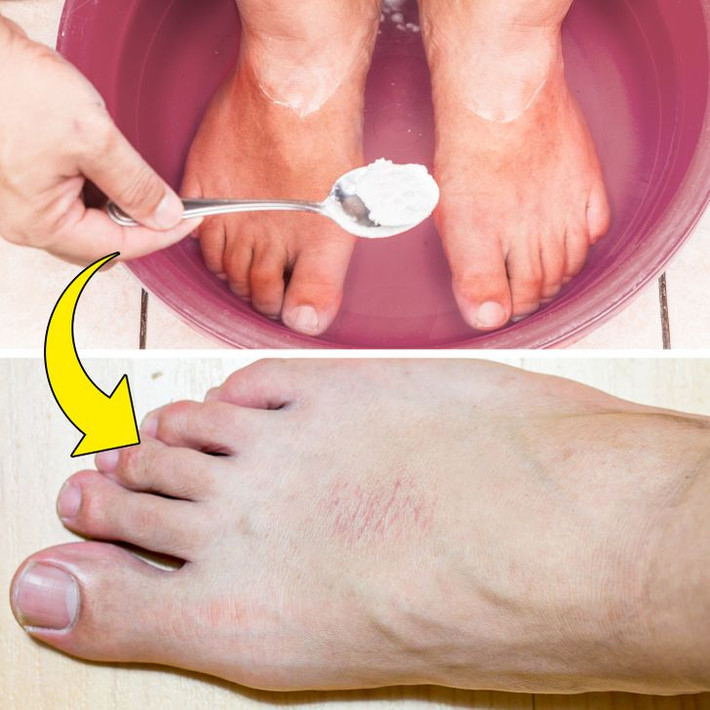8. Tắm bằng baking soda để giảm đau: Tắm bằng baking soda thường được sử dụng để điều trị một số tình trạng sức khỏe, từ giảm căng thẳng và đau đớn đến tăng cường tuần hoàn. Nhưng mức độ kiềm của nó có thể làm hỏng và gây kích ứng da. Ảnh: BS.