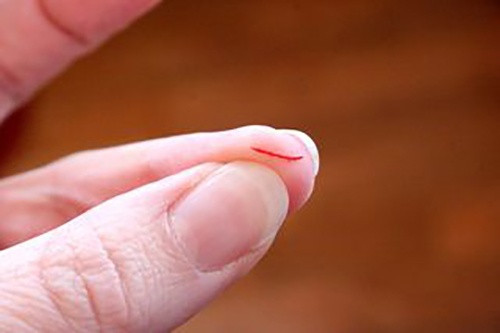 Thuốc lào sẽ giúp cầm máu ngay lập tức.