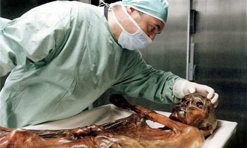 Không dừng lại ở đó, Helmut Simon, 69 tuổi, là một trong 2 nhà leo núi đã tìm thấy xác ướp tử vong sau khi bị ngã thác. Tiếp theo là Dieter Warnecke, 45 tuổi, người đứng đầu đội cứu hộ đã tìm kiếm cơ thể của ông Simon, cũng qua đời vì đau tim ngay sau khi tham dự tang lễ của nhà leo núi này.