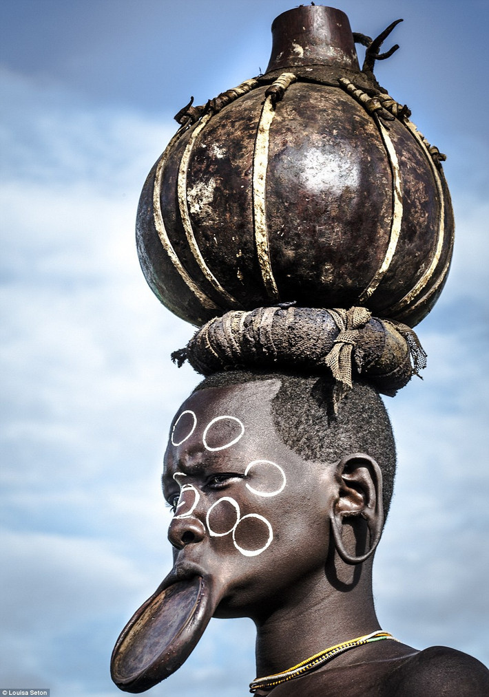 Người Surma - tên gọi chung cho người dân thuộc bộ tộc Suri và bộ tộc Mursi sống ở Ethiopia nổi tiếng với phong tục xẻ môi lồng đĩa. Phụ nữ có những chiếc khuyên bằng đĩa đeo trên vành môi dưới.