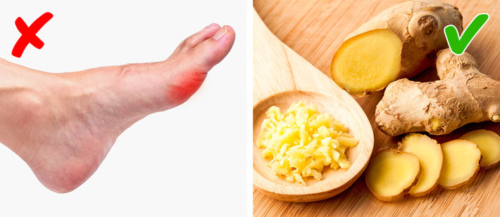 Trong một nghiên cứu khác, người ta chứng minh rằng gừng có khả năng kháng viêm rất hiệu quả, do đó có thể làm giảm cơn đau từ gout. Khi quá đau, chỉ cần ngậm một lát gừng, hoặc xay nhuyễn gừng và đắp lên vùng bị đau.