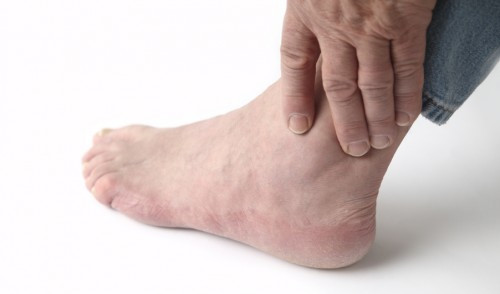 Khó vận động: Quá trình vận động của bệnh bị gián đoạn, rất khó vận động vì cơn đau buốt do xương khớp bị tổn thương viêm.