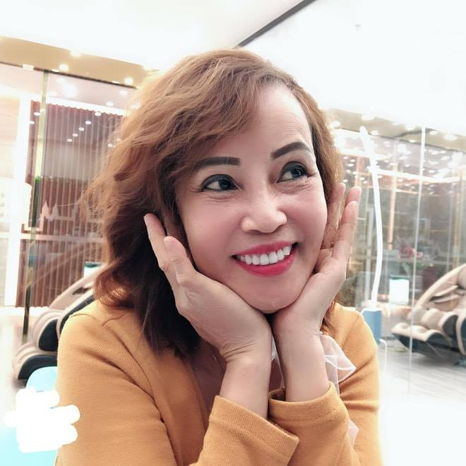 Thu Sao cho biết chị đã thực hiện phương pháp căng da mặt bằng mỡ tự thân ở bụng để cấy lên mặt. Nhiều người trầm trồ về gương mặt căng bóng, mịn màng của chị.