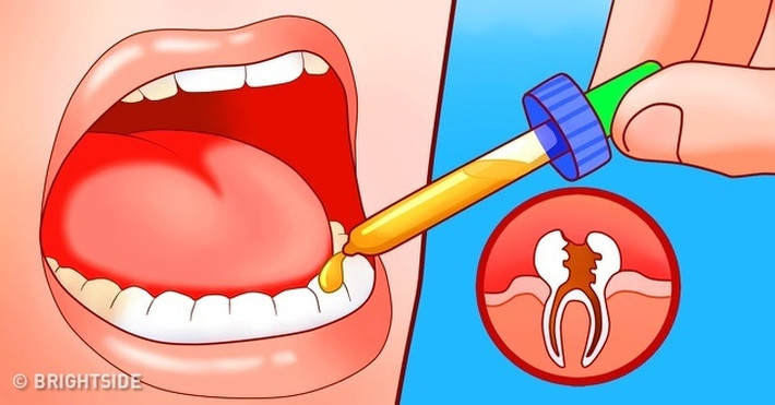Cỏ xạ hương thường được dùng để giảm đau, viêm, sốt và có thể điều trị đau khi mọc răng khôn. Bạn có thể pha loãng một vài giọt tinh dầu cỏ xạ hương vào dầu nền, sau đó dùng bông gòn hay ngón tay để thoa vào răng và nướu. Ảnh: Internet.