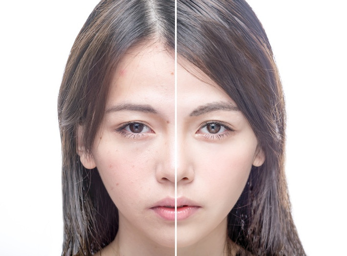 Sử dụng nước vo gạo này đổ lên tóc và nhẹ nhàng xoa bóp để ngấm vào da đầu. Sau đó gội sạch. Theo các nghiên cứu, nước gạo lên men có nhiều lợi ích: Nó giàu chất chống oxy hóa, khoáng chất và vitamin E giúp cải thiện độ đàn hồi của tóc, giúp tóc khỏe. Các axit amin trong nước gạo lên men giúp tăng cường sự chắc chắn của chân tóc. Ảnh: BS.