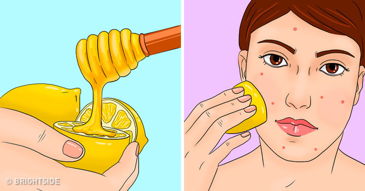 Việc bôi mặt nạ chanh với mật ong hai lần/tuần vừa ngăn mụn trứng cá vừa giảm nếp nhăn, giúp mặt mịn màng hơn. Ảnh: BS.
