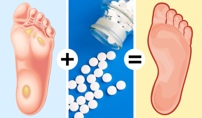 Aspirin trị các vết chai và nấm chân. Đổ 4 viên aspirin lấy bột để trộn với nước và nước cốt chanh. Bôi lên các vết chai chân và rửa sạch sau 20 phút. Thực hiện hai lần một tuần.