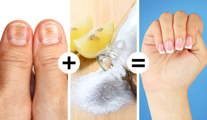 Hỗn hợp chanh và soda giúp tẩy trắng móng tay. Đây là mẹo làm đẹp rất hữu hiệu. Lấy một muỗng canh soda, một nửa muỗng cà phê dầu ô liu và một muỗng cà phê nước cốt chanh. Sử dụng bàn chải đánh răng mềm, chà hỗn hợp trên móng tay và rửa sau 5 phút.