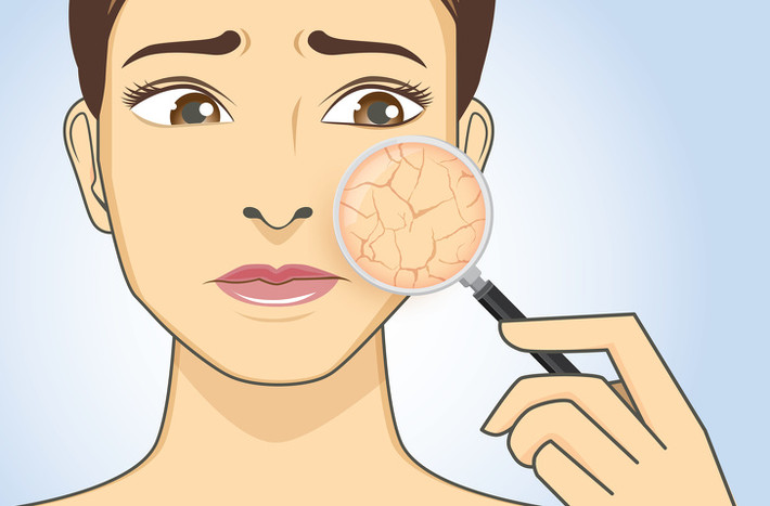 Da khô, bị kích thích bởi không khí khô nóng, có thể gây ngứa, nứt, nếp nhăn sớm và thay đổi màu sắc. Để ngăn chặn điều này, hãy tắm vòi sen bằng sữa tắm dưỡng ẩm thay vì xà phòng thông thường. Sau khi tắm, hãy bôi kem dưỡng ẩm da.