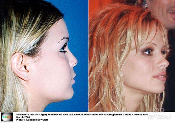 Cô gái 19 tuổi, Sha, người mẫu Playboy, muốn nổi tiếng như Pamela Anderson nên đã bơm ngực, môi và kết quả là ngoại hình của cô đã biến đổi như mong ước. (Ảnh: Wenn)