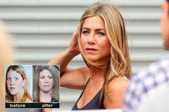 Kelly Chandler, một bà mẹ 27 tuổi ở Texas đã quyết tâm phẫu thuật thẩm mỹ để giống sao Hollywood Jennifer Aniston với mong muốn người chồng đã bỏ cô phải hối tiếc. (Ảnh: Ranker)