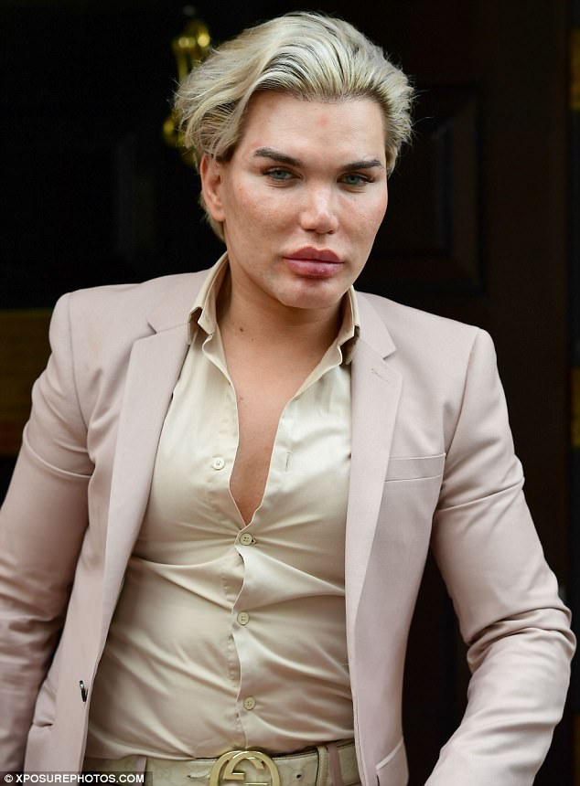 Búp bê sống Ken Doll, Rodrigo Alves nổi tiếng với những nỗ lực biến hình không ngừng nghỉ. Để trở thành một búp bê Ken Doll như hiện nay, Alves đã trải qua 57 cuộc phẫu thuật và tốn gần 400.000 bảng Anh. (Ảnh: Xposurephotos)