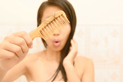 Rụng tóc: Rụng tóc do căng thẳng xuất hiện theo nhiều hình thức khác nhau. Tóc rụng khi chải đầu hay tắm gội; hệ miễn dịch tấn công vào nang tóc gây hiện tượng mất tóc... Hãy sớm đi gặp bác sĩ thăm khám nếu phát hiện nhiều mảng tóc trên đầu cũng rụng bất thường. Ảnh: Shutterstock.