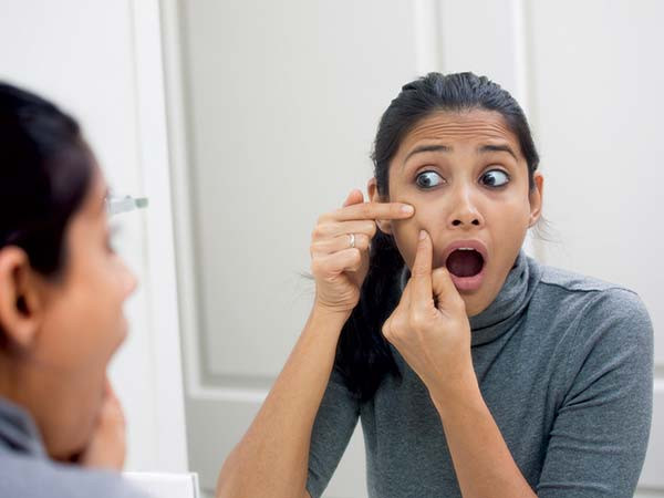 Mụn trứng cá: Một triệu chứng nổi bật của stress là nổi mụn trứng cá trên da; điều này là bởi vì các tế bào chịu trách nhiệm sản xuất sebum trộn với vi khuẩn da chết để tạo ra mụn nhọt. Stress có thể làm trầm trọng thêm sự xuất hiện của mụn trứng cá trên da của bạn. Ảnh: Boldsky.