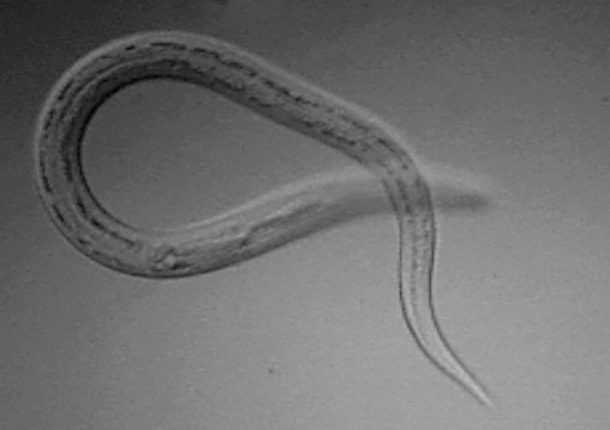 Liệu pháp điều trị bằng giun móc: Nếu bạn có suy nhược các bệnh như bệnh Crohn (bệnh viêm mãn tính của ruột), bệnh đa xơ cứng, hen hoặc bệnh viêm ruột, sử dụng liệu pháp giun sán có thể là một lựa chọn. Ảnh: Healthline.