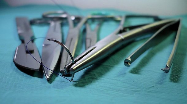 Phẫu thuật nội soi tự nhiên: Thay vì rạch một vết trên da, phẫu thuật nội soi tự nhiên đi qua hậu môn, miệng, niệu đạo hoặc một lỗ khác; sau đó các bác sĩ thực hiện một vết rạch bên trong dạ dày. Hình thức điều trị này vẫn còn đang thử nghiệm và nhận được nhiều tranh luận trong cộng đồng y tế. Tuy nhiên, phương pháp này có thể loại bỏ một số loại ung thư nhất định. Ảnh: Ncbi