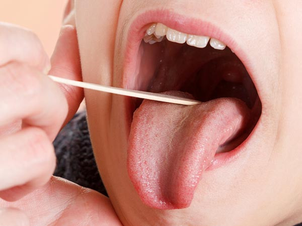 3. Giúp điều trị các vấn đề về đường hô hấp: Nước ép khoai tây giúp ngăn ngừa các bệnh hô hấp khác nhau vì nó làm giảm lượng glucose trong máu. Ảnh: Boldsky.