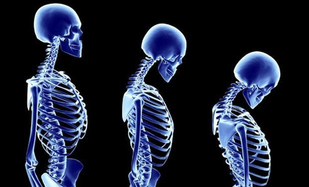 14. Khi mới sinh, cơ thể người có 300 xương, nhưng khi trưởng thành chỉ còn 206. Phần lớn chúng không hề biến mất mà do kết hợp lại với nhau. Ảnh: CDN.