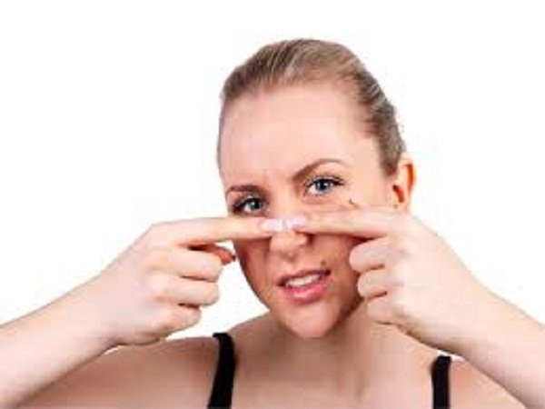 Thói quen nặn mụn chỉ thúc đẩy vi khuẩn vào da sâu hơn và làm cho mụn nổi nhiều hơn. Điều này thậm chí lây lan vi khuẩn sang các bộ phận khác của khuôn mặt bạn.
