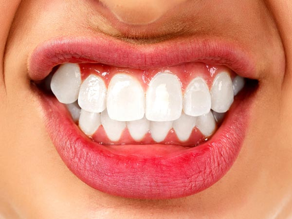 6. Nghiến răng thường là do thói quen ngủ hoặc căng thẳng. Thói quen hại răng này rất khó kiểm soát.