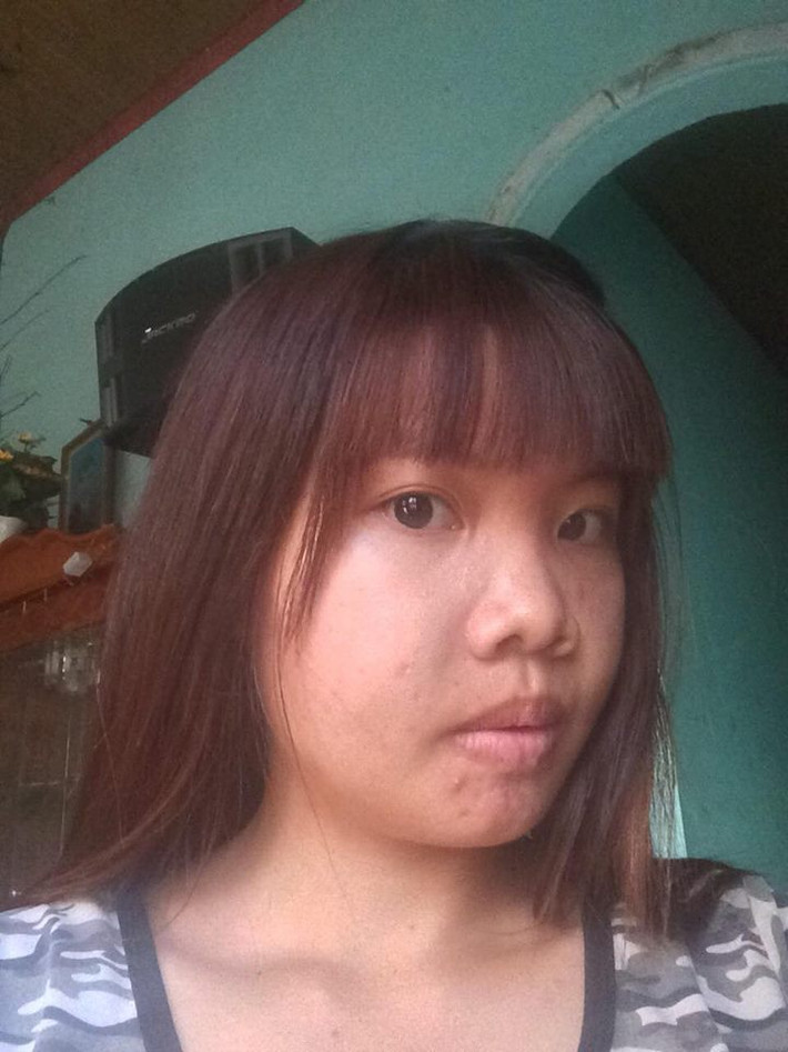 Dù biết gia đình làm nương rẫy vất vả, kinh tế cũng bình thường nhưng Kim Phượng vẫn cố gắng thuyết phục bố mẹ cho cô được đi phẫu thuật thẩm mỹ. Thấy con gái quyết tâm, bố mẹ Phượng cuối cùng cũng chấp nhận mặc dù vẫn lo nếu không may con gái làm phẫu thuật thẩm mỹ hỏng thì lại xấu cả người.
