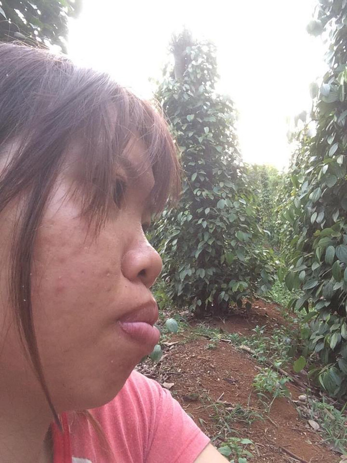 Kim Phượng tâm sự, cô nhận thức được rằng mình có nhan sắc xấu xí bắt đầu từ năm lớp 8, khi thường xuyên bị bạn bè xa lánh và trêu chọc là "bàn nạo dừa" do Phượng sở hữu hàm hô từ nhỏ. Xấu hổ và buồn tủi vì không có bạn bè, cô nữ sinh 9X nghỉ học sớm và theo bố mẹ vào Đăk Nông làm nương rẫy.