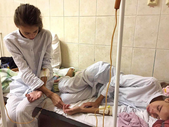 Đã có lúc các bác sĩ gần như đã tuyệt vọng và chỉ có thể có gắng duy trì nhịp đập cho cặp song sinh. Thế rồi thần may mắn cũng mỉm cười với Daria và Maria, tình trạng của họ dần biến chuyển tốt và cuối cùng cũng hồi phục.