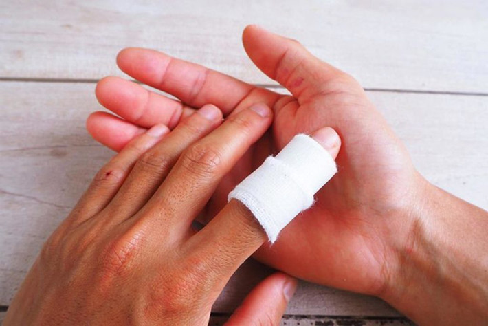Một trong những dấu hiệu khác của bệnh là vết thương lâu lành do mạch máu bị hư hỏng vì quá nhiều đường lưu thông qua tĩnh mạch và động mạch.