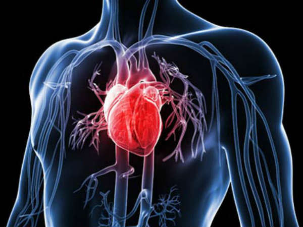 Bệnh mạch vành làm hạn chế lưu lượng máu và oxy đến cơ tim, dẫn đến ngừng tim đột ngột.