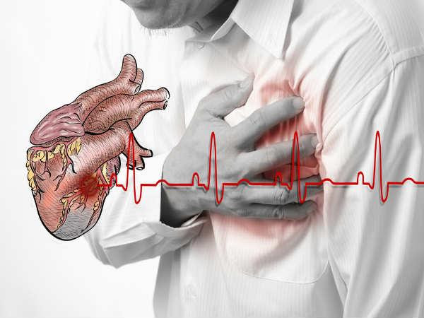 Hội chứng Brugada là một chứng rối loạn nhịp tim hiếm. Triệu chứng chính của hội chứng brugada là nhịp tim không đều và nếu không được điều trị thì có thể dẫn đến ngừng tim đột ngột.