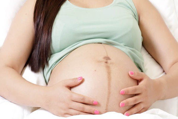 Đường sọc nâu chạy dọc dưới bụng:Từ tam cá nguyệt thứ hai trở đi, mẹ bầu bắt đầu thấy xuất hiện 1 đường thẳng sậm màu chạy giữa bụng dưới. Đường lằn bụng này hình thành do sự thay đổi nội tiết tố, khi cơ bụng căng ra và hơi tách biệt để tạo không gian lớn hơn cho em bé trong bụng.