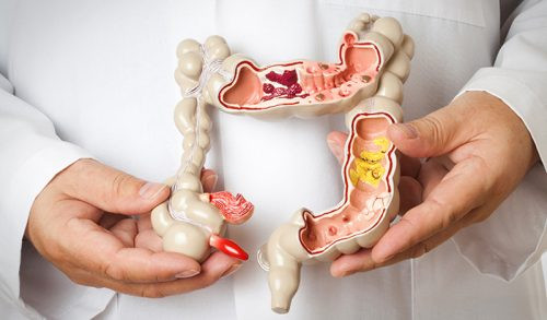 Hỗ trợ tiêu hóa: Uống nước nghệ ấm giúp đào thải các độc tố và chất thải ra ngoài cơ thể. Ngoài ra, thức uống này cũng kích thích sản sinh các vi khuẩn lành mạnh trong thành dạ dày, do đó cải thiện tiêu hóa.