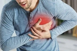 Ông Hoàng Nam Tiến đột ngột qua đời, cách gì phòng tránh đột quỵ não?
