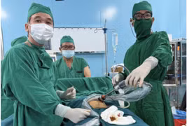 Bóc tách khối u chứa da, tóc cho người phụ nữ ở Côn Đảo