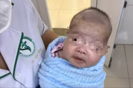 Trẻ bú kém, quấy khóc không ngờ uốn ván sơ sinh nguy kịch