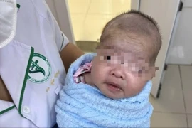 Trẻ bú kém, quấy khóc không ngờ uốn ván sơ sinh nguy kịch