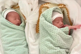 Hai trẻ song sinh bất thường ra đời khỏe mạnh nhờ chẩn đoán trước sinh